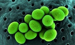 Ureaplasma urealyticum